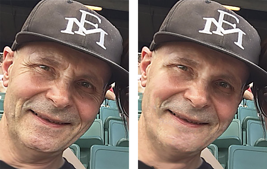 Ross wrinkle comparison